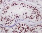 Anti-Chk2 CHEK2 Rabbit Monoclonal Antibody